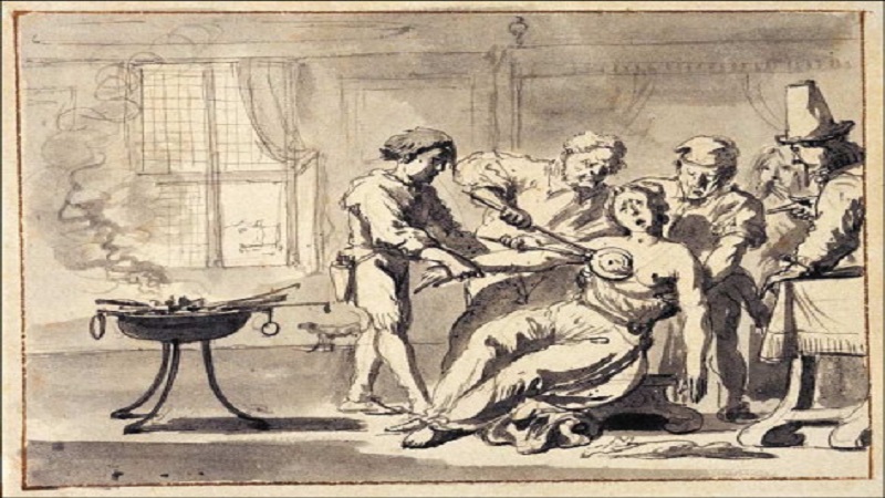 افضل دكتور سرطان الثدي في العراق | تاريخ تشخيص سرطان الثدي