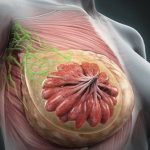 تقييم العُقد اللِّمفَية