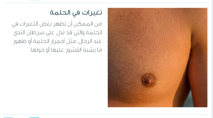 جراح پستان اصفهان |