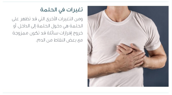 جراح پستان اصفهان |