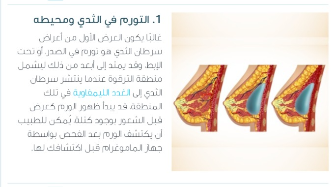 جراح پستان اصفهان |