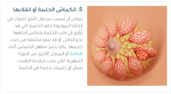 جراح پستان اصفهان |