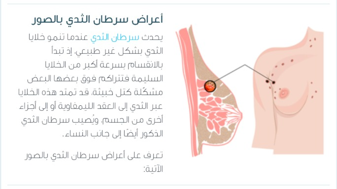 جراح پستان اصفهان |