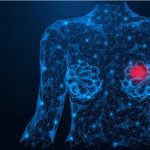 ظهور الكتل في الثدي