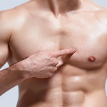 علاجه جراحة التثدي