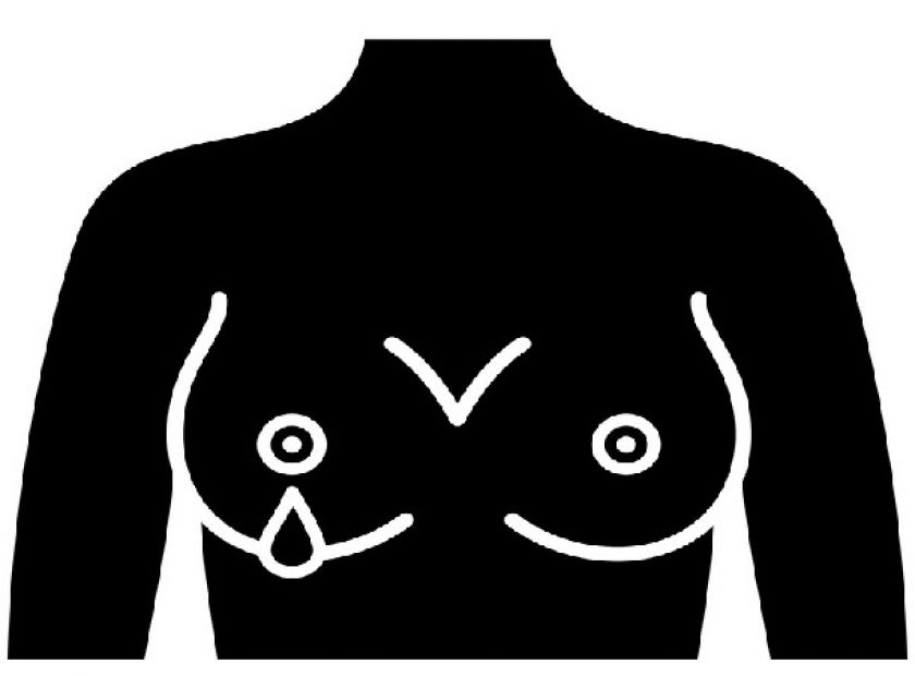 Nipple discharge glyph icon