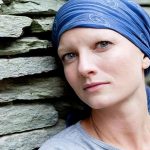 ریزش مو سر در شیمی درمانی